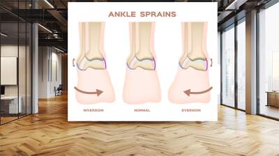 ankle sprains vector Wall mural