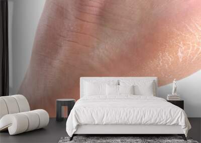 The heel of foot with bad skin covered with cracks Wall mural