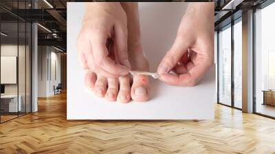 A woman glues a plaster for the treatment of calluses and calluses to her toe. Close-up Wall mural