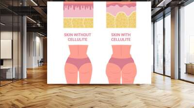 Young woman thighs with and without cellulite. Girl in underwear Wall mural