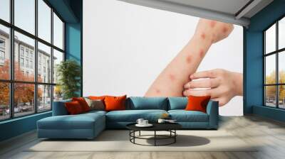 Concept of epidemic of monkey pox virus, white woman scratching skin, red rash, pustules and abscess, itching after being infected with monkeypox virus. Wall mural