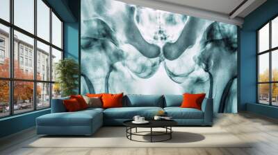 X-ray image of a human hip joint, showing the bones and surrounding tissue. Wall mural