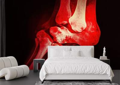 X-ray image of a human knee joint showing bone structure and potential damage. Wall mural