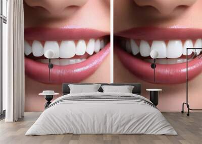 Before and After Teeth Whitening Close-Up Horizontal Comparison Wall mural