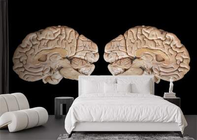 Real human half brain anatomy isolated on black background Wall mural