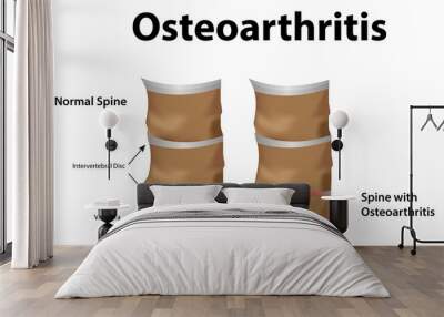 Osteoarthritis Wall mural