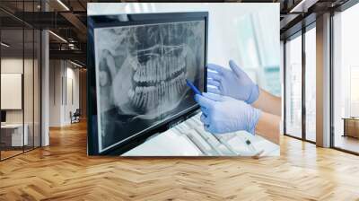 Hands doctor dentist in gloves show the teeth on x-ray on digital screen in dental clinic on light background with medical equipment. Smile healthy teeth concept, close up Wall mural