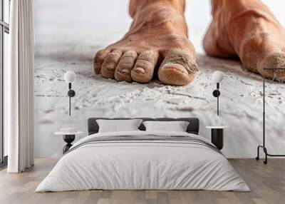 Closeup of a persons feet with dry, flaky skin, on a white floor Wall mural