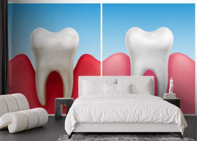 Vector illustration of gum disease -  periodontitis in compare with healthy white tooth Wall mural