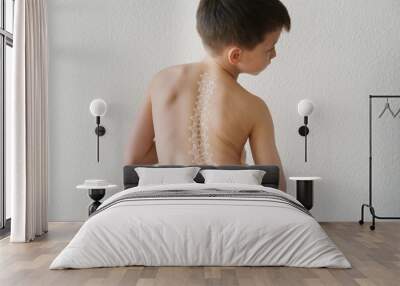 naked back of boy, child 8-10 years old grabbed a sore spot, curved spine, pain in spine, concept of therapeutic massage for osteochondrosis, scoliosis, back pain, intervertebral hernia Wall mural