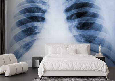 X Ray or Fluorogram of Human Thorax   - Medical Tuberculosis Diagnostic Test - Xray, MRI, CT Scan Film
 Wall mural