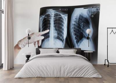 Doctors hands holding x-ray photo of lungs showing disease. Covid-2019 Coronavirus infection  Wall mural