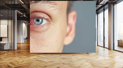 Close up of the red eye of a man affected by an infection, copy space Wall mural