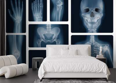 Human Bones Realistic X-ray Shots Wall mural