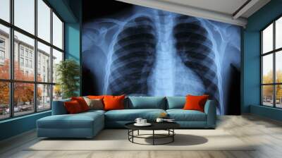 Pulmonary Radiography Wall mural