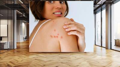 A woman scratches her shoulder bitten by a bedbug on a white background, close-up. Skin health problem. Red pimples. Wall mural