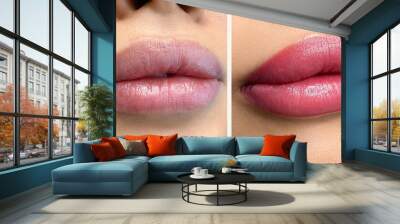 permanent makeup on the lips of a young woman of a delicate peach shade close-up, a girl after a cosmetic procedure with smooth and clean healthy skin.	
 Wall mural