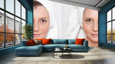 happy woman after beauty treatment - before/after shots - skin care, anti-aging procedures, rejuvenation, lifting, tightening of facial skin Wall mural