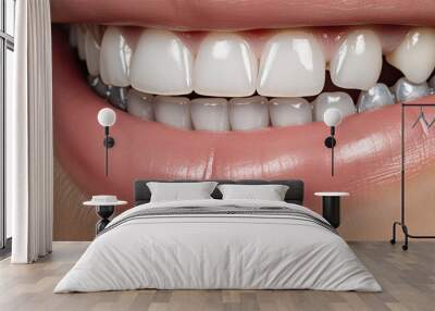 Close-up of a perfect smile with white teeth Wall mural