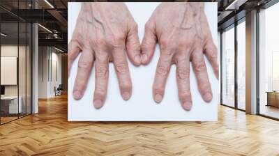 Osteoarthritis Hands and fingers of a female's hands. Wall mural