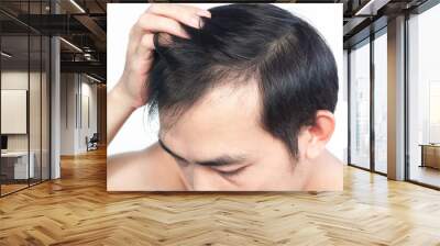 Closeup Young man serious hair loss problem with white backgroun for health care medical and shampoo product concept, selective focus Wall mural