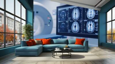 Illustration of understanding stroke and vascular brain issues, brain health. MRI images on the monitor screen	
 Wall mural