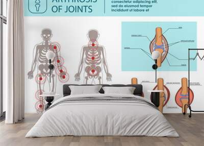 Arthrosis of Joints. Vector Illustration. Wall mural