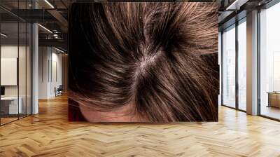 Unhealthy head skin. Problem hair loss, dandruff.  Wall mural