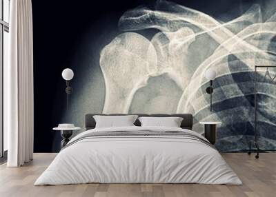 X-ray Any Positioning Wall mural