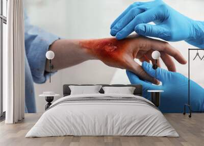 Doctor examining terrible patient's burn of hand indoors, closeup Wall mural