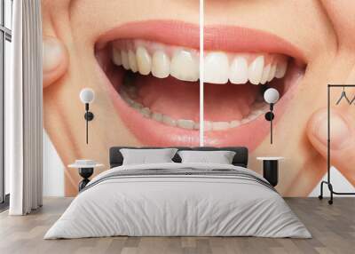 Smiling woman before and after teeth whitening procedure, closeup Wall mural