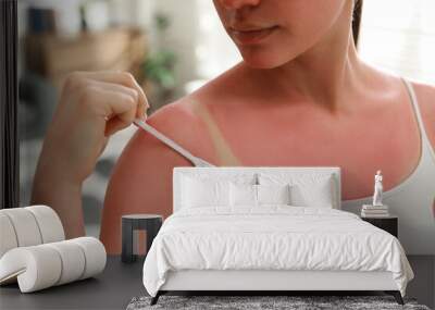 Woman with sunburned skin at home, closeup Wall mural