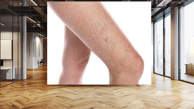 Woman with varicose veins on white background, closeup Wall mural