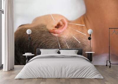 Young man undergoing acupuncture treatment in salon, closeup Wall mural