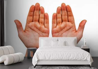 Close up empty working hands palms with red traces red calluses chafing isolated on white background Wall mural