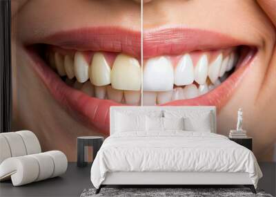 Close-up of teeth showing dramatic before and after results of whitening treatment Wall mural