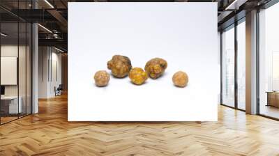 Gallstones,multiple cholesterol stone in gall bladder with cholecystitis . Wall mural