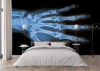 x ray of a human hand Wall mural