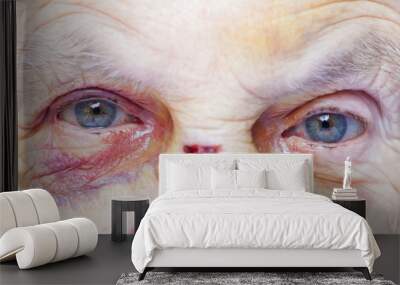 Injured elderly woman Wall mural