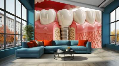 3d illustration of dental implant with white tooth Wall mural