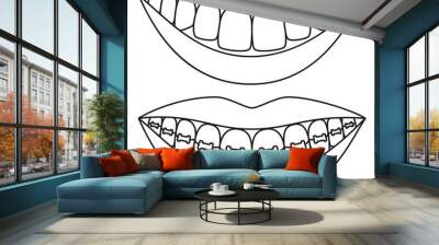 Line art black and white teeth aligning concept Wall mural