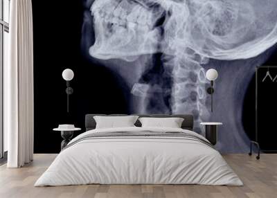 skull x-ray image Wall mural