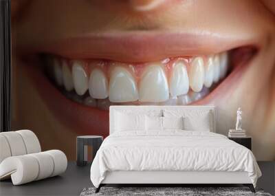 Close-up of a joyful smile highlighting bright white teeth. Wall mural