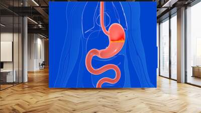 Anatomical 3D illustration of stomach with heartburn and reflux. On a transparent glass woman's body showing the internal organs. Wall mural