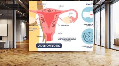 Adenomyosis pain cancer heavy disease disorder uterine surgery tissue cycle enlarged bigger abdomen female menses profuse polyp medical reproduction Wall mural