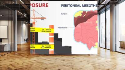 Asbestos breath chest pain testes ascites Hydrocele scrotum Swollen Difficulty fluid pleura testicle tunica vaginalis dust tract safe safety carcinogen smoking hazard danger tissue toxic silica copd Wall mural