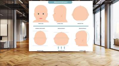 craniosynostosis helmet pillow flat head autism brain skull bone deformity baby infant child newborn defect birth anterior Metopic Born genes genetic position sleep shape deformation tummy time  Wall mural