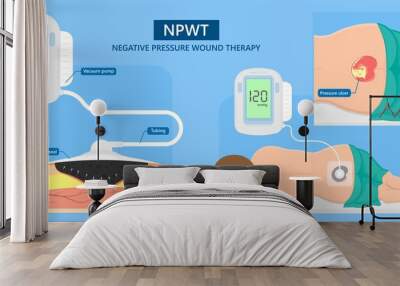 Vacuum assisted closure VAC drain tube treat dead damage pain medicine sealing healing diagnose exam technique surgery therapeutic suction high blood sugar test feet leg level loss air body Venous Wall mural