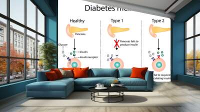 Diabetes mellitus type 1, pancreas's failure to produce enough insulin  and type 2, cells fail to respond to insulin (Insulin resistance). Result in high blood glucose levels. Vector illustration
 Wall mural