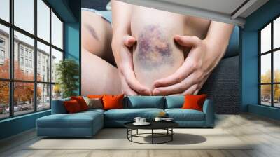 bruise injury on young woman knee. close up image of female person sitting on sofa and holding in ha Wall mural